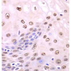 Sequestosome 1 (SQSTM1) Antibody