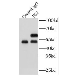 Sequestosome 1 (SQSTM1) Antibody