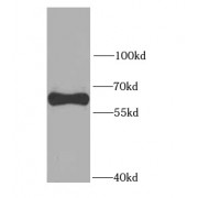 WB analysis of HEK-293 cells, using SQSTM1 antibody (1/1000 dilution).