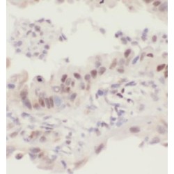 p63 Antibody