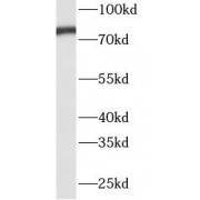 WB analysis of A431 cells, using TP63 antibody (1/1000 dilution).