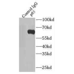 p65; RELA Antibody