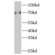 WB analysis of mouse brain tissue, using p75NTR antibody (1/1000 dilution).