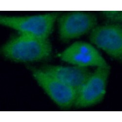 Protein-Arginine Deiminase Type-2 (PADI2) Antibody