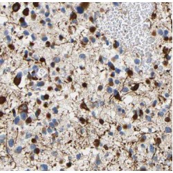 Protein-Arginine Deiminase Type-2 (PADI2) Antibody