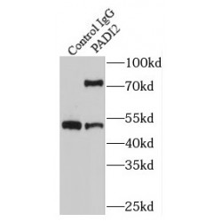 Protein-Arginine Deiminase Type-2 (PADI2) Antibody
