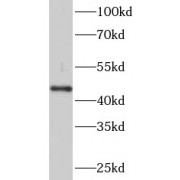 WB analysis of BxPC-3 cells, using PADI2 antibody (1/500 dilution).