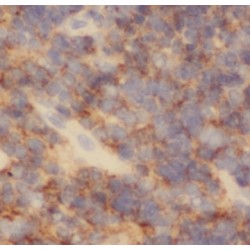 Platelet-Activating Factor Acetylhydrolase 2, Cytoplasmic (PAFAH2) Antibody