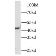 WB analysis of PC-12 cells, using SERPINE1 antibody (1/1000 dilution).