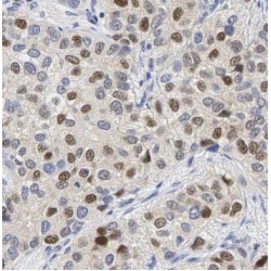Serine/threonine-Protein Kinase PAK 1 (PAK1) Antibody