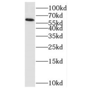 WB analysis of Jurkat cells, using PAK1 antibody (1/1000 dilution).