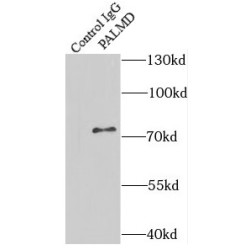 Palmdelphin (PALMD) Antibody