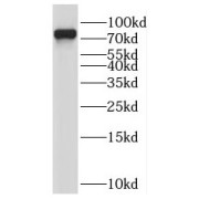 WB analysis of HeLa cells, using PALMD antibody (1/300 dilution).