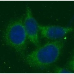 Pantothenate Kinase 2 (PANK2) Antibody
