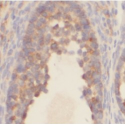 3'-Phosphoadenosine 5'-Phosphosulfate Synthase 1 (PAPSS1) Antibody