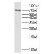 WB analysis of HepG2 cells, using PAPSS1 antibody (1/500 dilution).