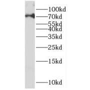 WB analysis of HepG2 cells, using PAPSS2 antibody (1/300 dilution).