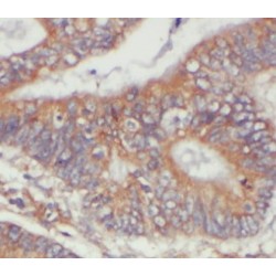 Par-3 Partitioning Defective 3 Homolog (PARD3) Antibody