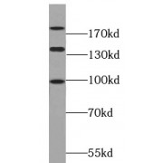WB analysis of MCF7 cells, using PARD3 antibody (1/500 dilution).