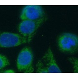 E3 Ubiquitin-Protein Ligase Parkin (PRKN) Antibody