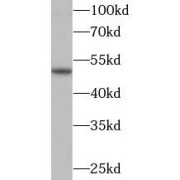 WB analysis of PC12 cells, using Parkin antibody (1/1000 dilution).