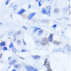 Poly ADP-Ribose Polymerase 1 (PARP1) Antibody
