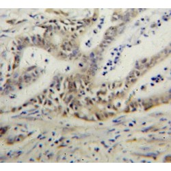 Poly ADP Ribose Polymerase 3 (PARP3) Antibody