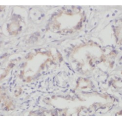 Parvin Alpha (PARVA) Antibody