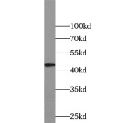 abx236172