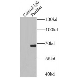Paxillin (PXN) Antibody