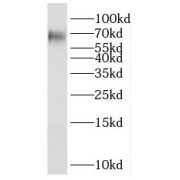 WB analysis of mouse brain tissue, using PXN antibody (1/1000 dilution).