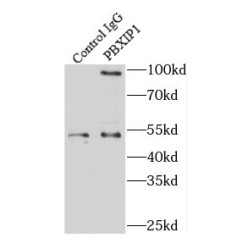 PBX Homeobox Interacting Protein 1 (PBXIP1) Antibody