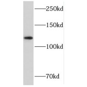 WB analysis of A431 cells, using P-cadherin antibody (1/1000 dilution).