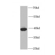 WB analysis of HeLa cells, using PCBP2 antibody (1/1000 dilution).