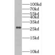 WB analysis of HEK-293 cells, using PCMT1 antibody (1/1000 dilution).