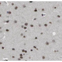 Purkinje Cell Protein 4 Like 1 (PCP4L1) Antibody