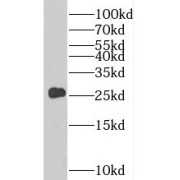 WB analysis of human liver tissue, using PCTP antibody (1/300 dilution).