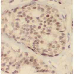 Programmed Cell Death Protein 4 (PDCD4) Antibody