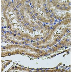 Programmed Cell Death 6-Interacting Protein (PDCD6IP) Antibody