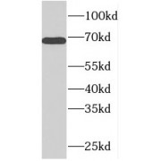 WB analysis of human heart tissue, using PDE1C antibody (1/500 dilution).