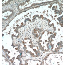 Phosphodiesterase 6A (PDE6A) Antibody