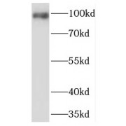 WB analysis of A549 cells, using PDE6B antibody (1/3000 dilution).