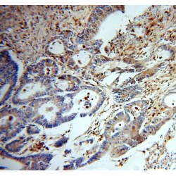 PD-ECGF Antibody