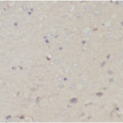 Pyruvate Dehydrogenase E1 Component Subunit Alpha, Somatic Form, Mitochondrial (PDHA1) Antibody