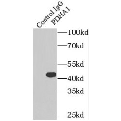 Pyruvate Dehydrogenase E1 Component Subunit Alpha, Somatic Form, Mitochondrial (PDHA1) Antibody