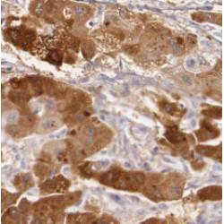 Pyruvate Dehydrogenase E1 Component Subunit Alpha, Somatic Form, Mitochondrial (PDHA1) Antibody