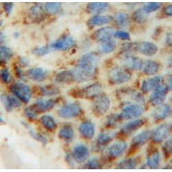 Pyruvate Dehydrogenase Beta (PDHB) Antibody