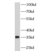 WB analysis of human heart tissue, using PDHB antibody (1/300 dilution).