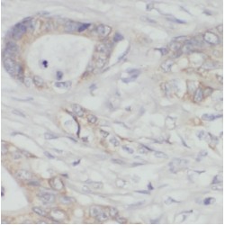 Pyruvate Dehydrogenase Complex Component X (PDHX) Antibody