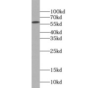 WB analysis of COLO 320 cells, using PDIA1 antibody (1/500 dilution).